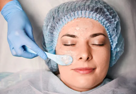 Chemical Peel and Skin Resurfacing at Vasavi Hospitals