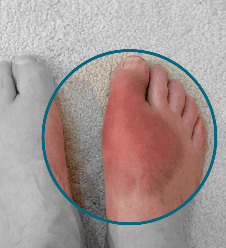 Diabetic foot care and treatment offered at Vasavi Hospitals to prevent serious complications.