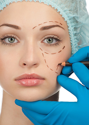 Facial marking for cosmetic surgery at Vasavi Hospitals Bangalore