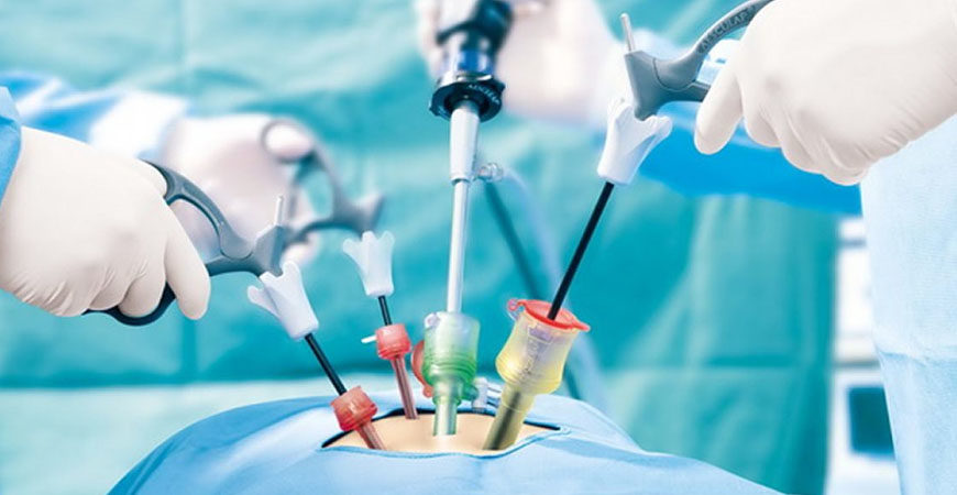 Advanced laparoscopic instruments used in minimally invasive surgery at Vasavi Hospitals Bangalore.