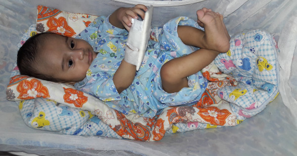Newborn baby receiving neonatal care with IV bandage at Vasavi Hospitals Neonatology unit.