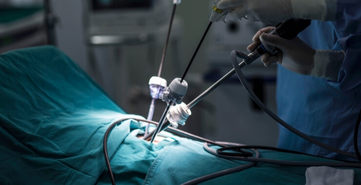 Robotic and laparoscopic surgery performed at Vasavi Hospitals Bangalore with advanced technology.