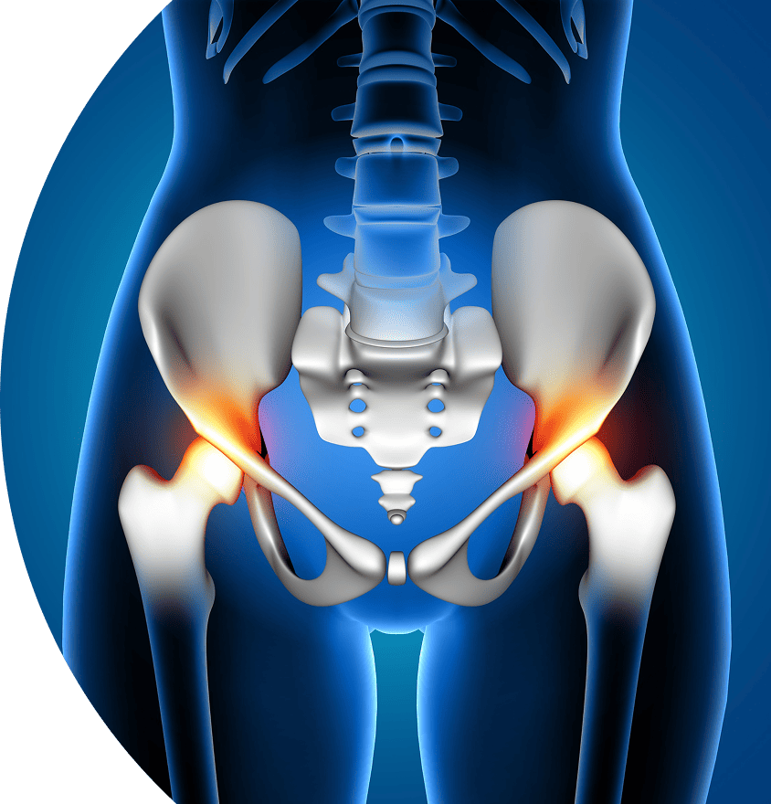 Hip and pelvis treatment at Vasavi Hospitals, Bangalore