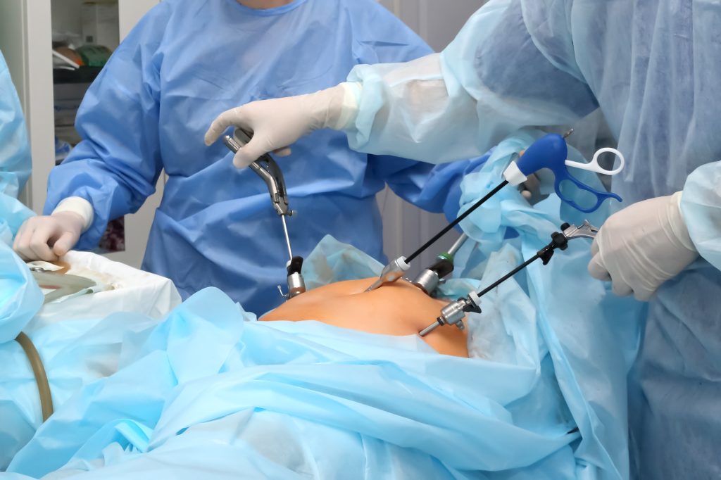 Doctors performing laparoscopic surgery with advanced minimally invasive techniques in a sterile operation theatre at Vasavi Hospitals Bangalore